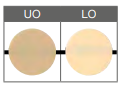 LO.png